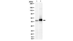 phospho-cytokeratin-8 (K8) (Ser431), Mouse anti-Human, Mouse, Clone: 5B3,